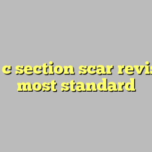 10+ c section scar revision most standard