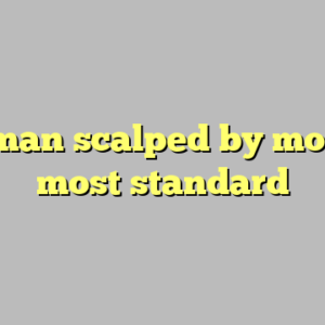 10+ man scalped by monkey most standard